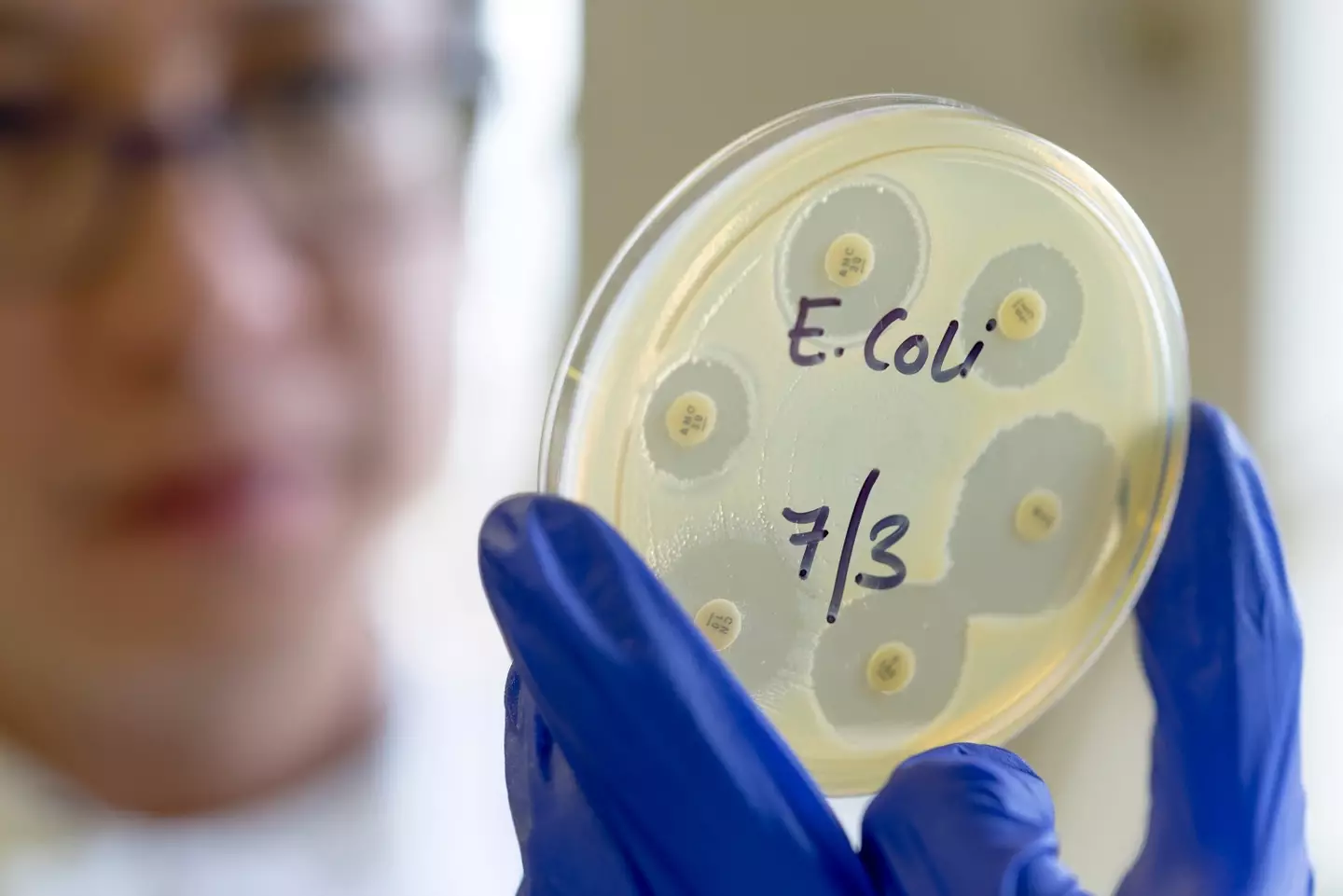 The government has issued advice on how to avoid the bacteria. (Getty Stock Photo)