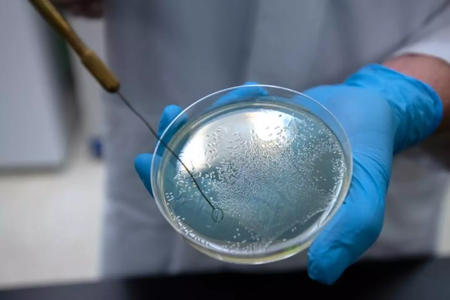 Petri dish containing salmonella bacteria. (Ted S. Warren, Washington State University College of Veterinary Medicine)