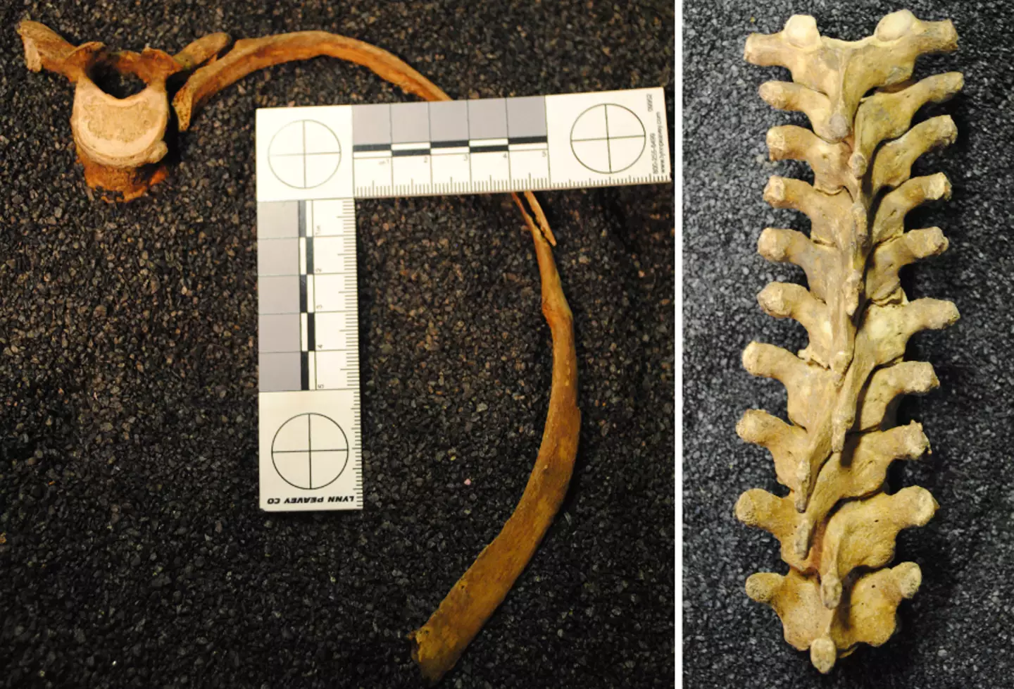 Research shows that the regular wearing of corsets led to deformities of the ribs and spine (Museum of London)