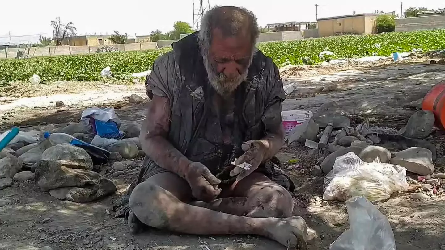 Scientists Baffled By Good Health Of 87-Year-Old Who Hasn't Washed for 65 Years And Eats Roadkill