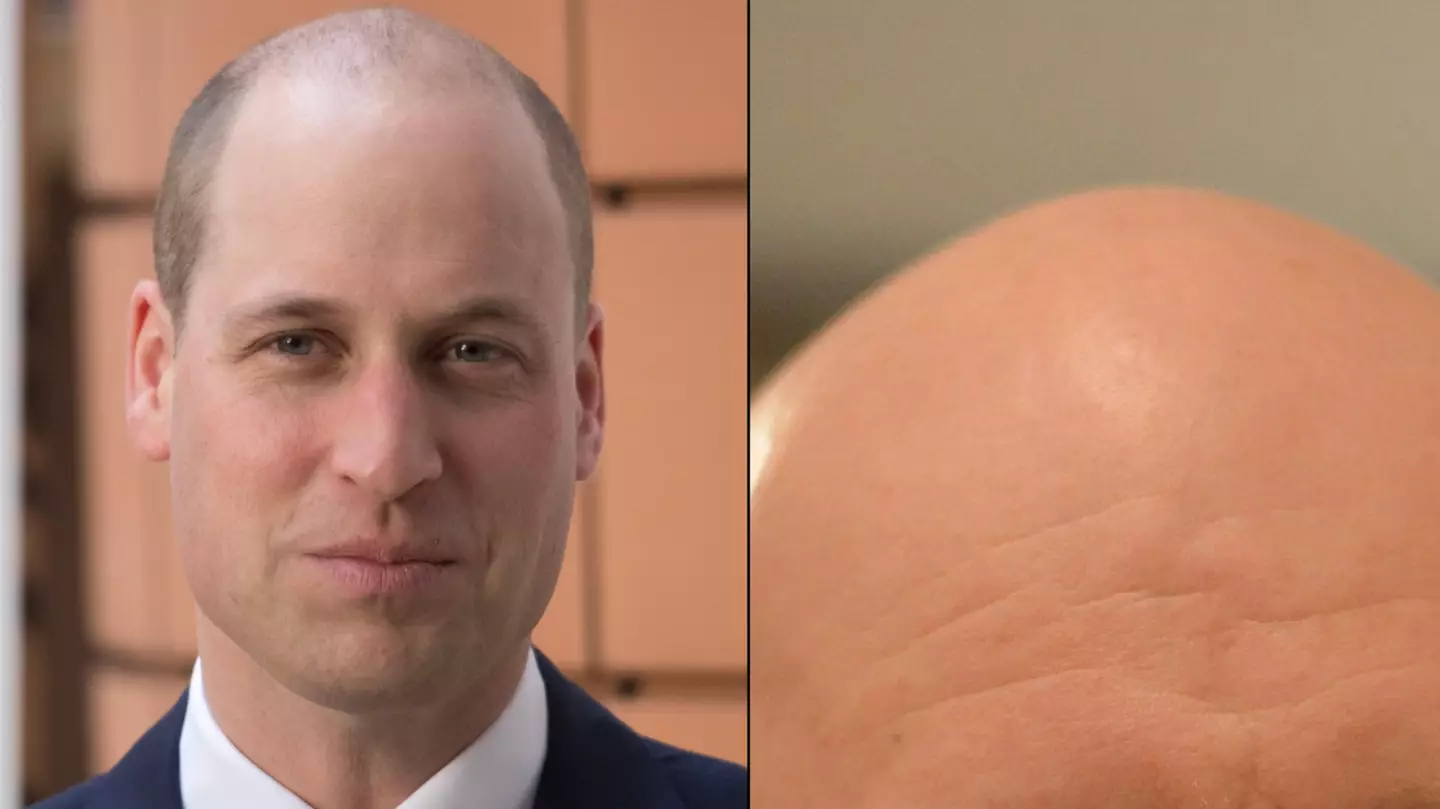 Prince William has been dethroned as 'world's hottest bald man'