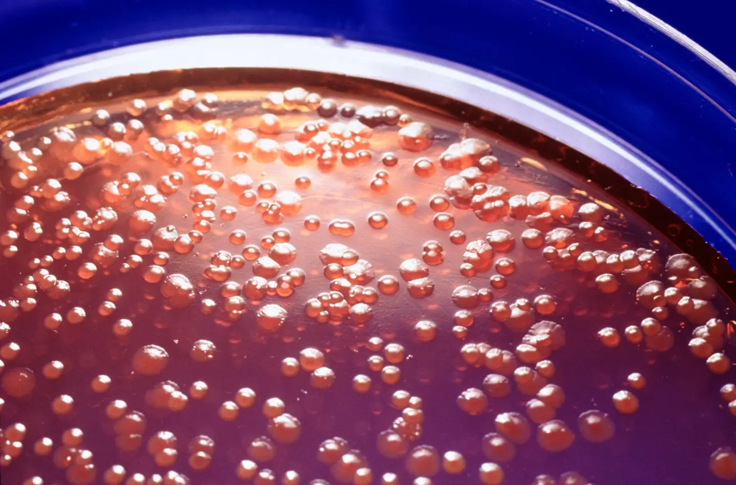 Salmonella bacteria. (Getty Stock Image)
