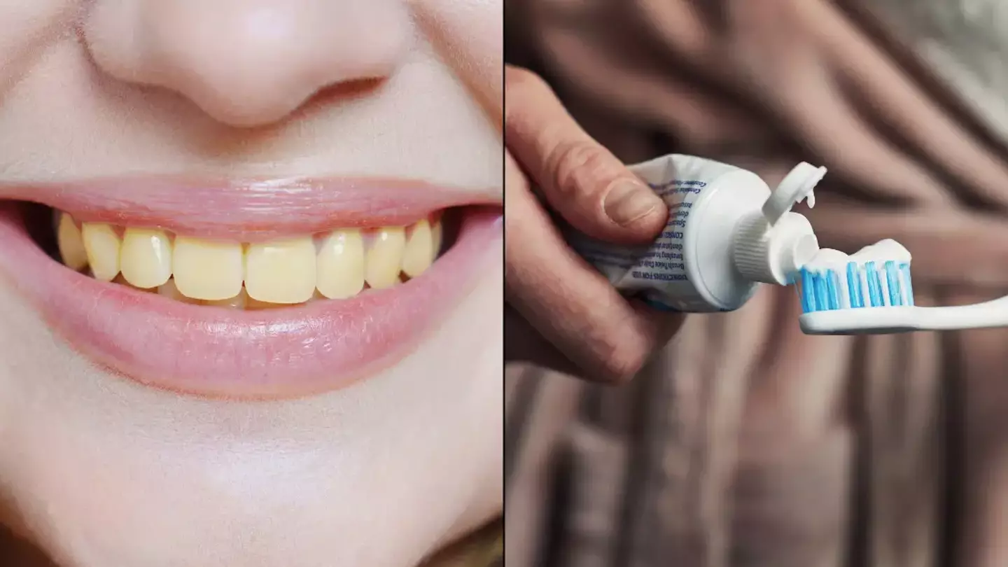 There's one reason your teeth will start to go yellow over time that you might not be able to avoid