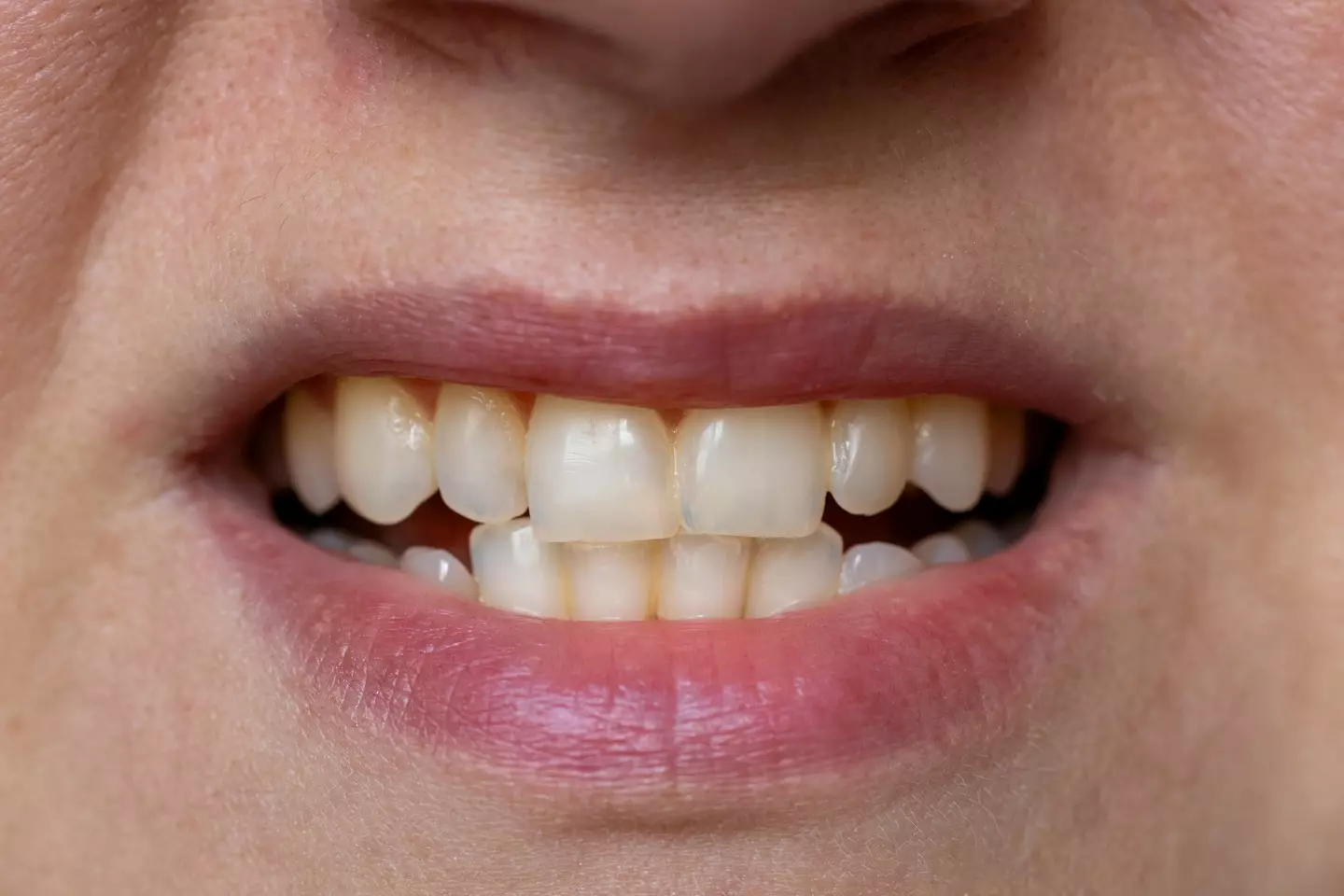 You probably don't want your teeth turning yellow (Getty Stock Image)