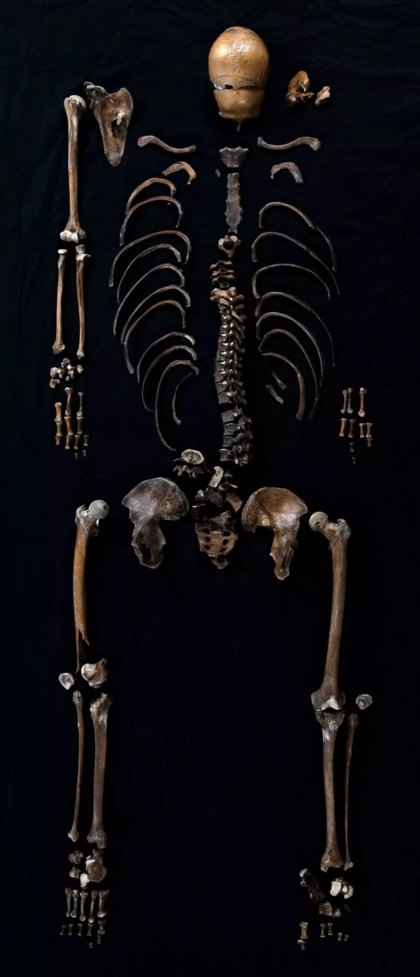 The 'Well Man' skeleton (Åge Hojem NTNU Vitenskapsmuseet)