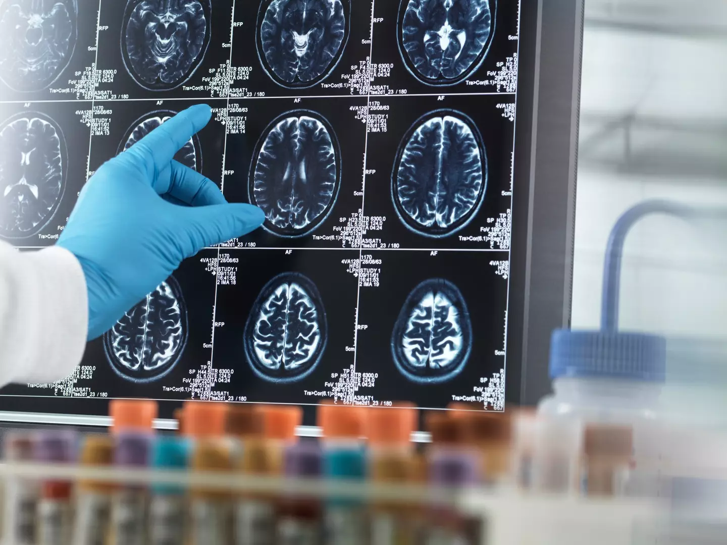 A dementia expert has revealed there are two questions that can help confirm a suspected diagnosis (Getty Stock Photo)