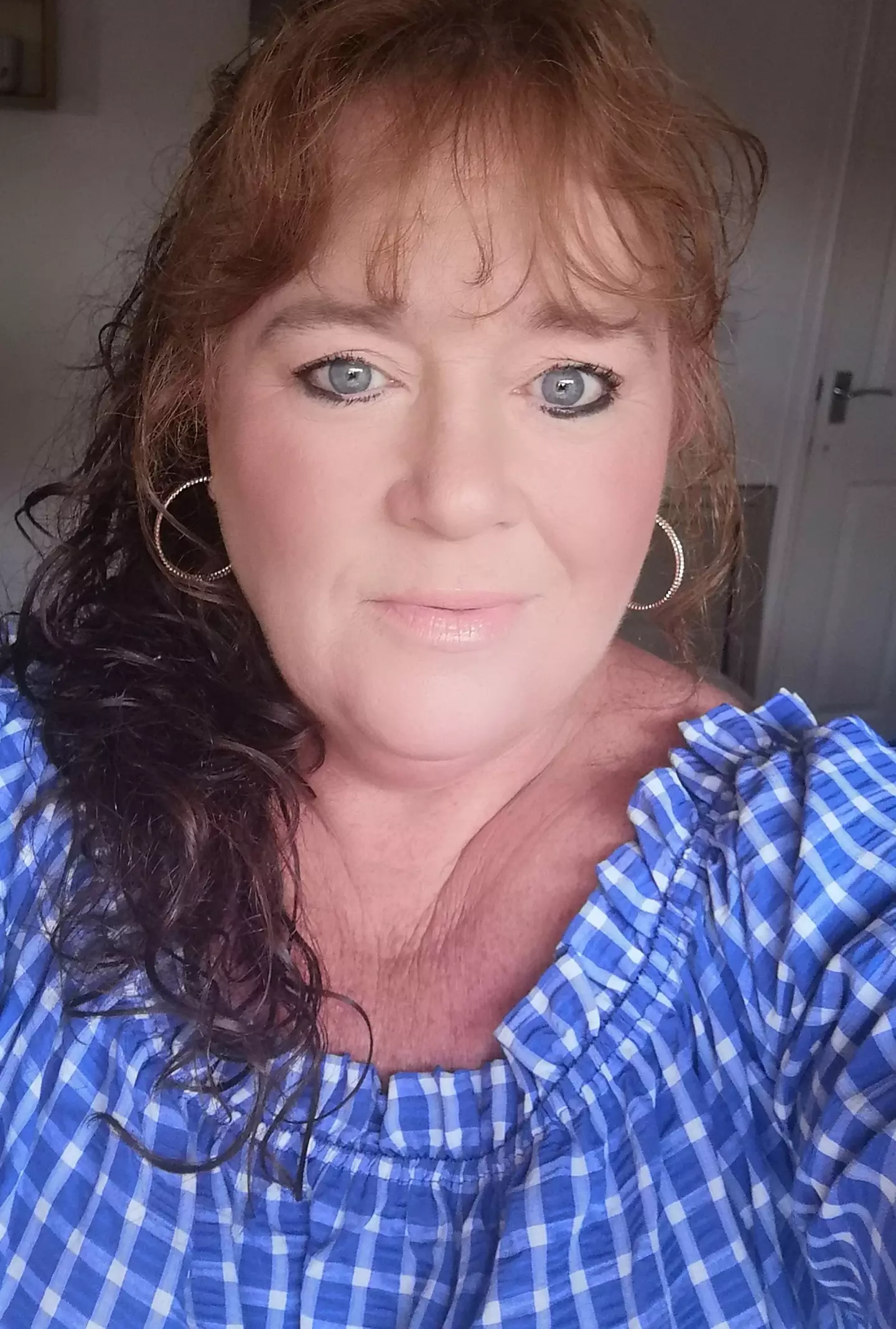 Joanne Law before her surgery (Kennedy News and Media)