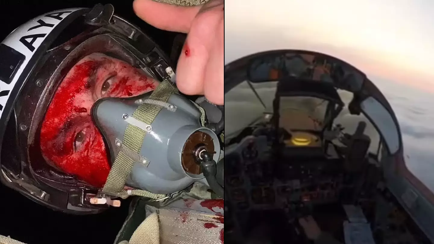Heroic Ukrainian pilot takes selfie covered in blood after drone battle