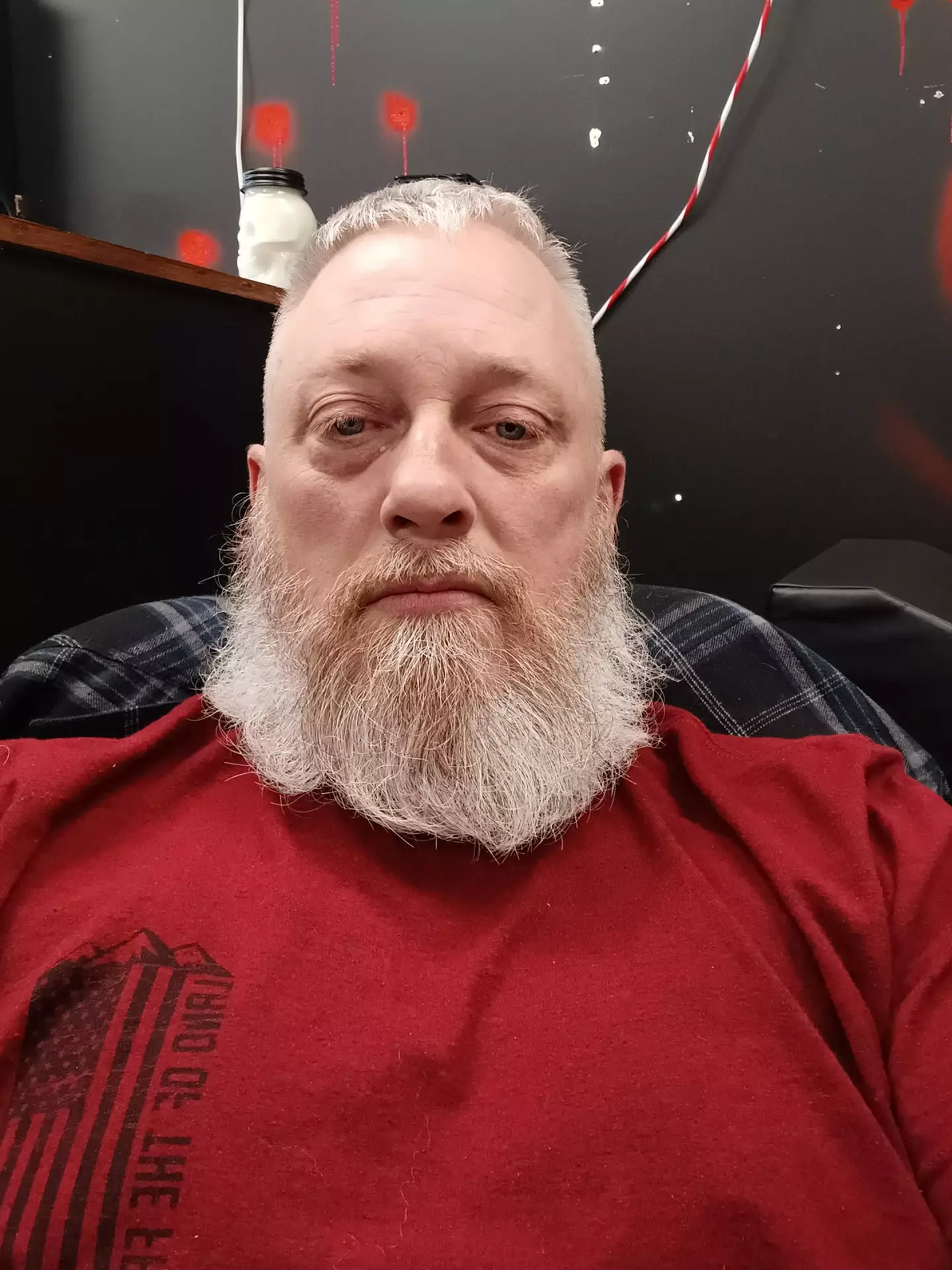 Dustin coughed up three pints of blood as a result of his vape addiction.
