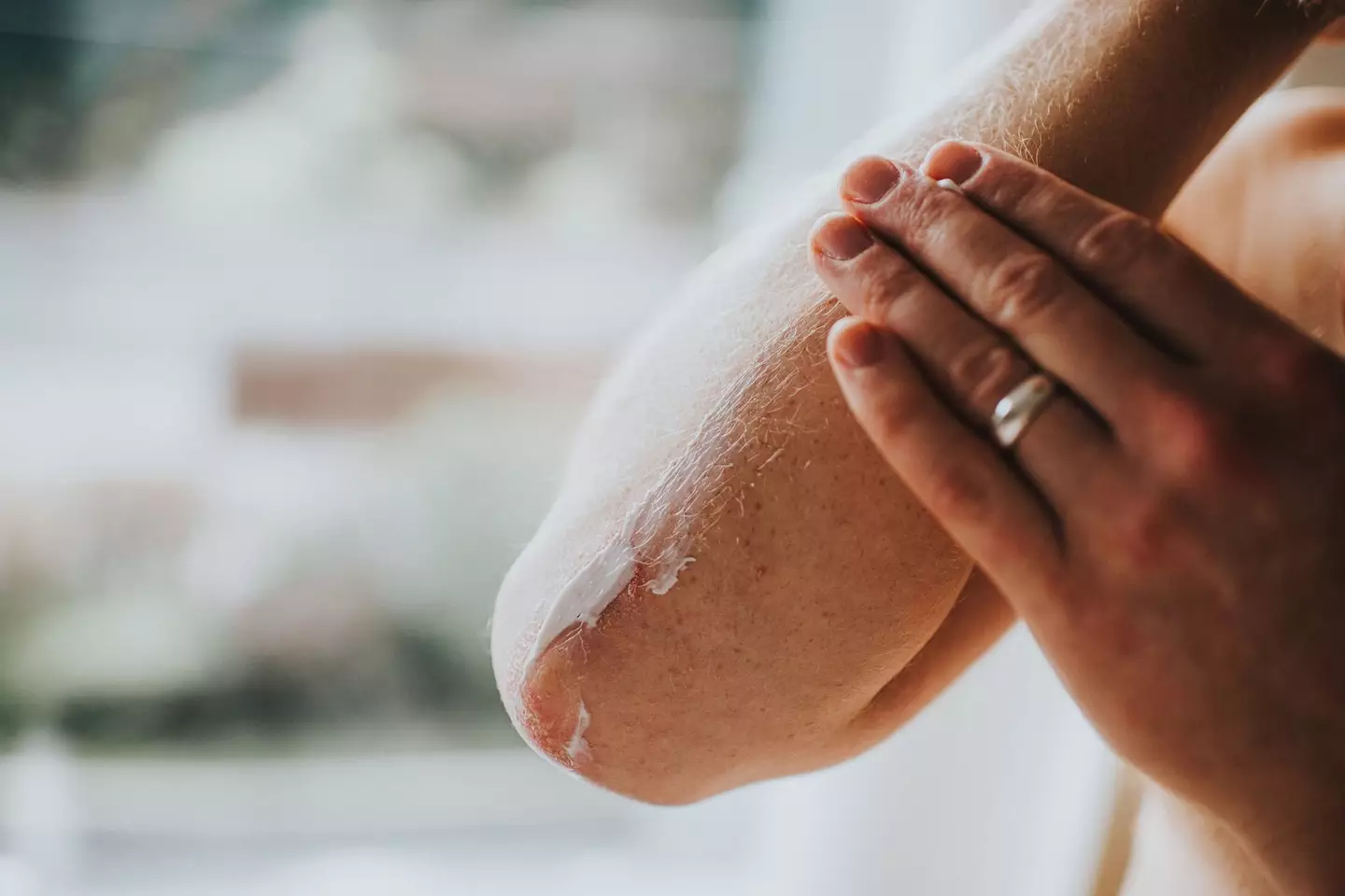 Maybe your dry skin isn't a weather issue. (Getty Stock Images)