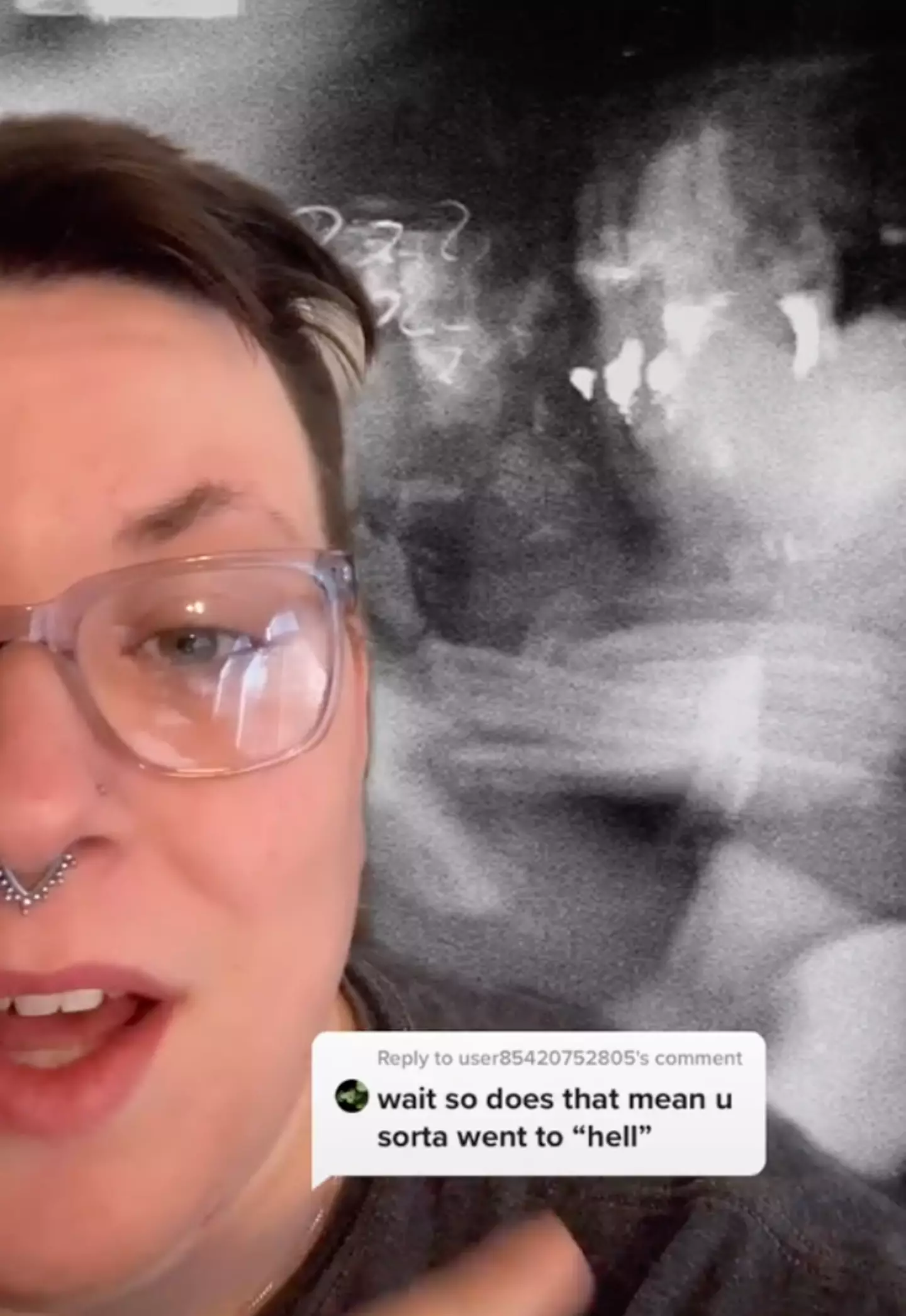 Raychul compared the 'black pit' part of the vision to this image of a mosh pit.