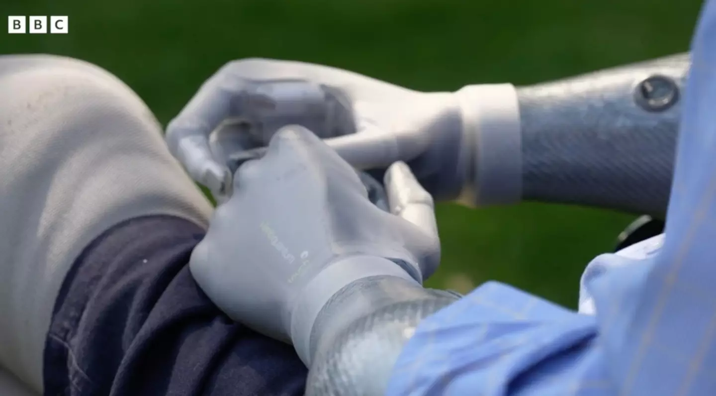 The dad wants to be known as Britain's first 'bionic' MP (BBC)