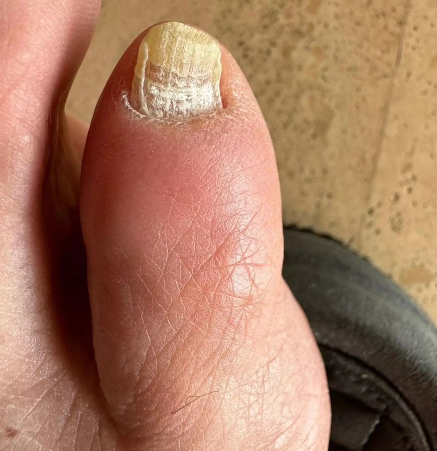Yikes.