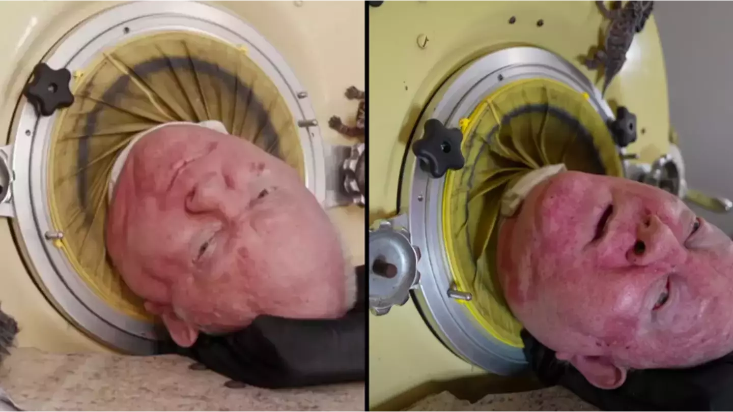 Man who lived inside iron lung for more than 70 years has sadly died aged 78