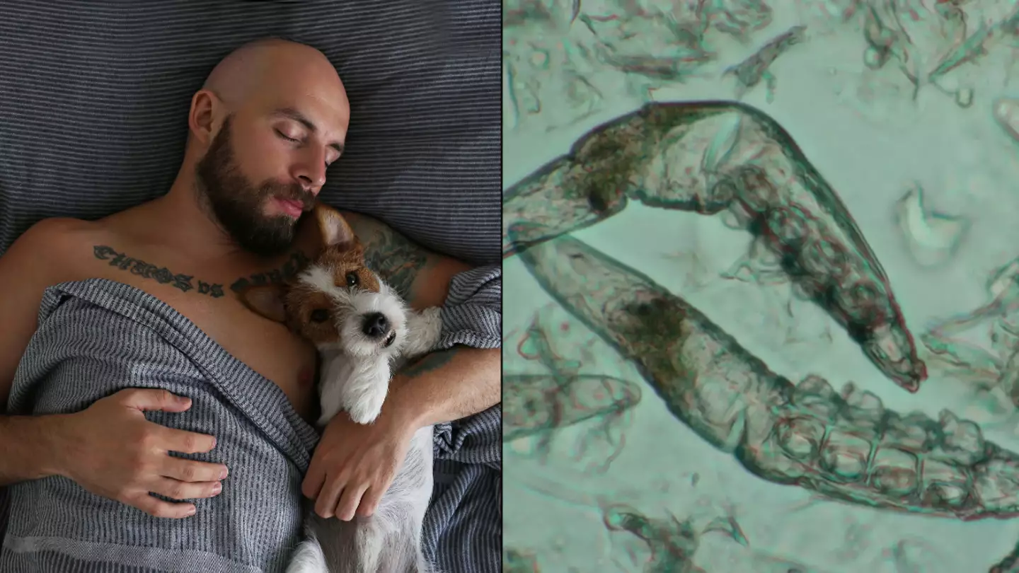 How to avoid parasitic eye infection caught by common bedroom habit that millions of people do