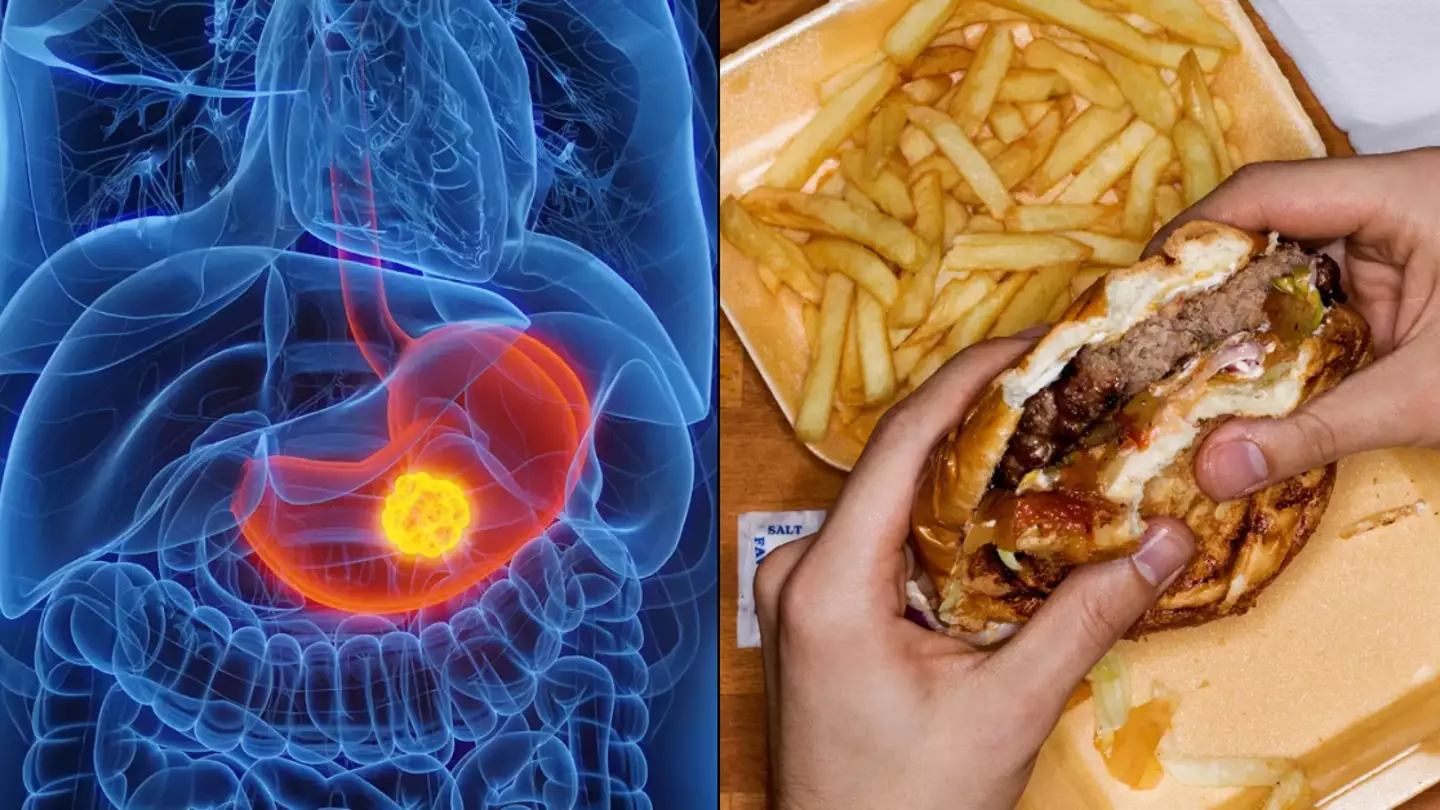How to prevent disease following doctor's worrying claim that 'every new patient' at cancer clinic is under 45