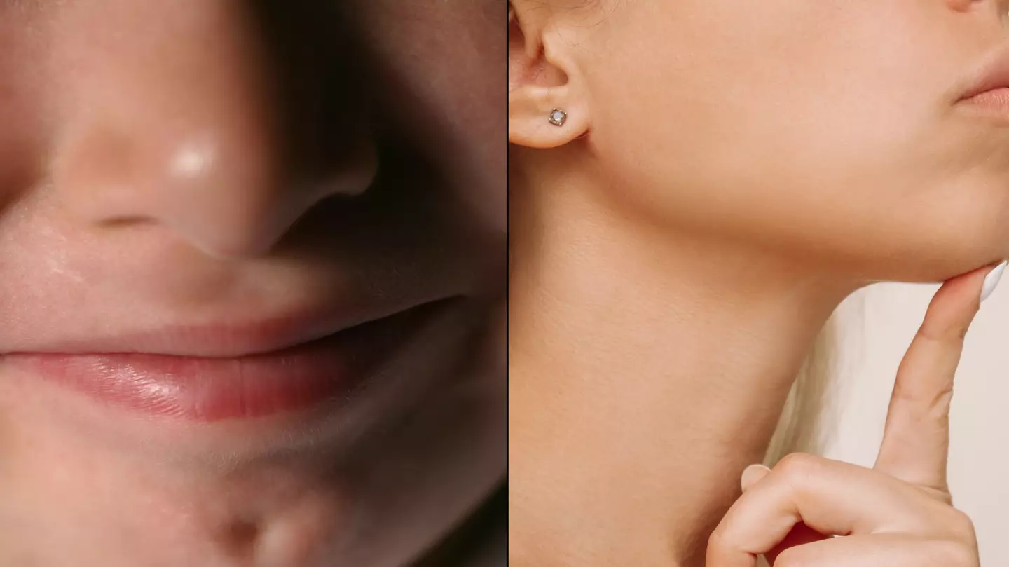 People are getting very upset after learning what chin dimples are