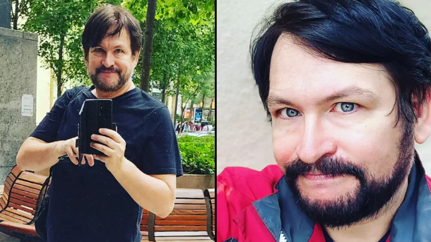 Man with 'world's biggest penis' claims to have slept with A-list celebrities