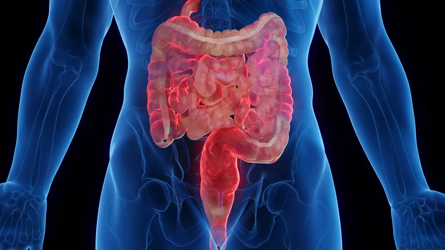 Eating common plant extract could prevent bowel condition that five million people live with