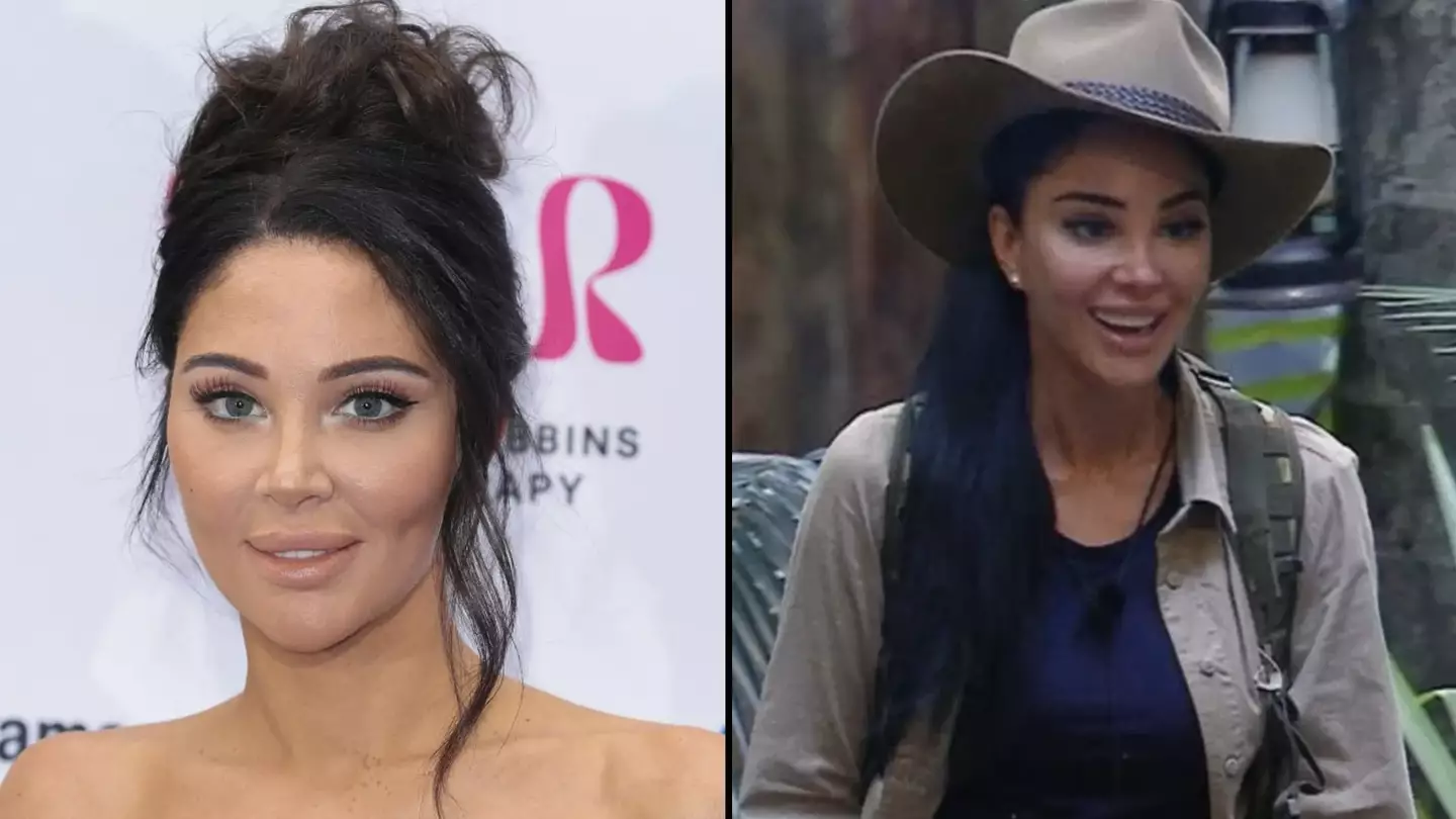 I’m A Celeb's Tulisa has revealed heartbreaking reason behind getting cosmetic facial surgery
