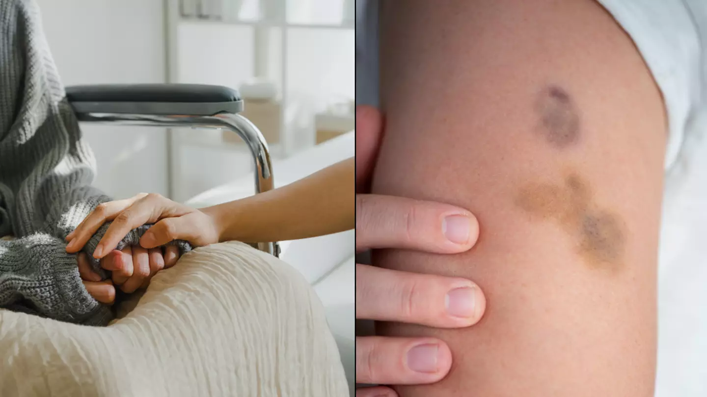 Health experts reveals the eight early warning signs of leukaemia you should never ignore