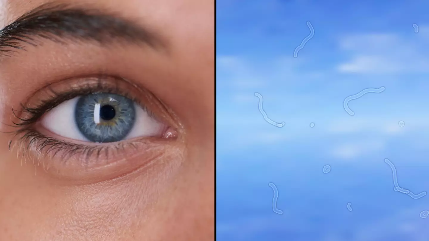 Expert explains what you should do if you start seeing these 'floaters' in your eyes