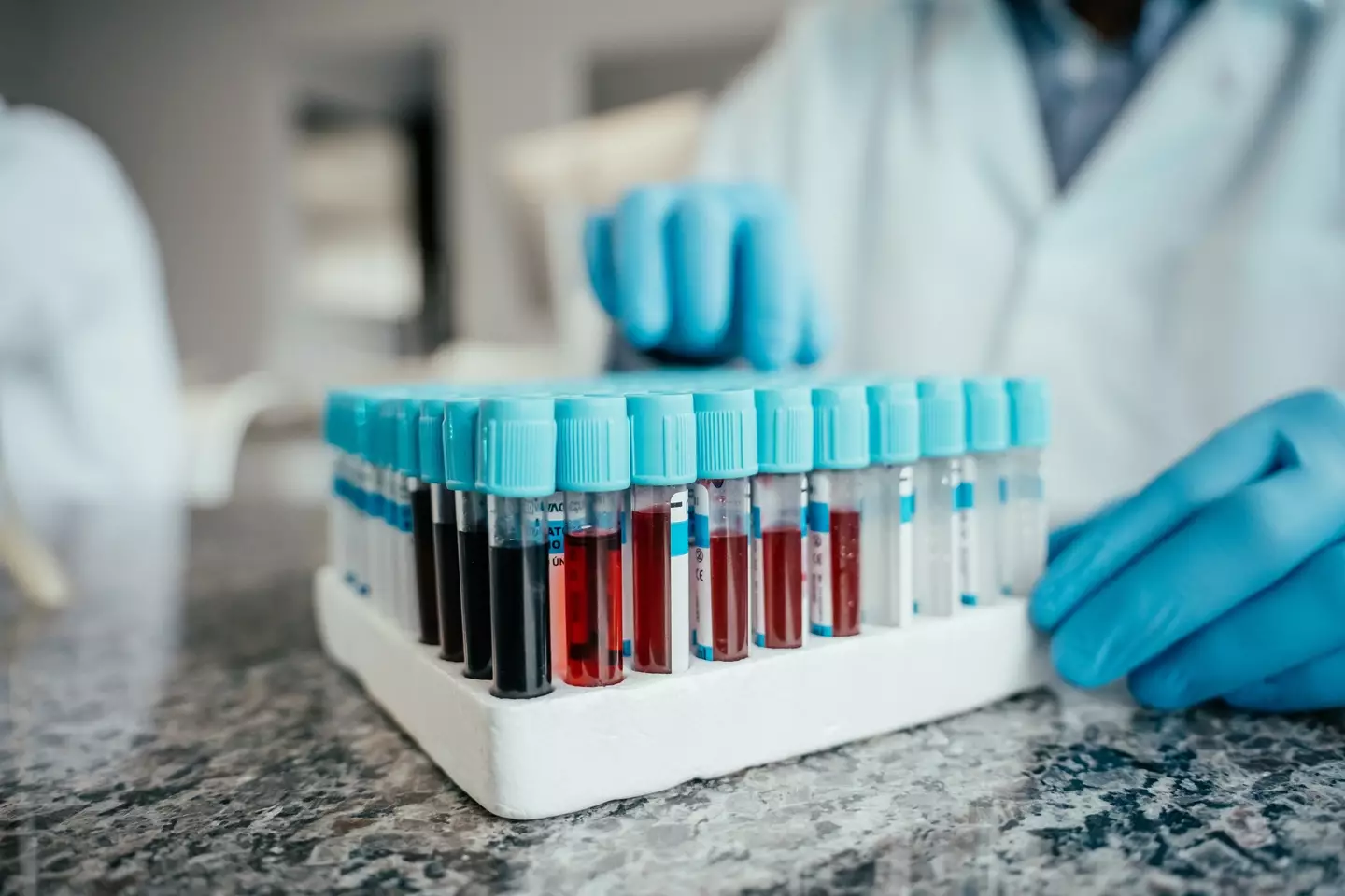 Doctors were able to work out what was wrong with the family after realising their blood was 'chocolate coloured' due to a lack of oxygen (Getty Stock Images)