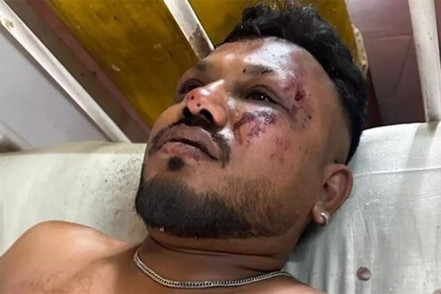 He was taken to a general ward at the Civil Hospital Asarwa in Ahmedabad after the crash (Hindustan Times)