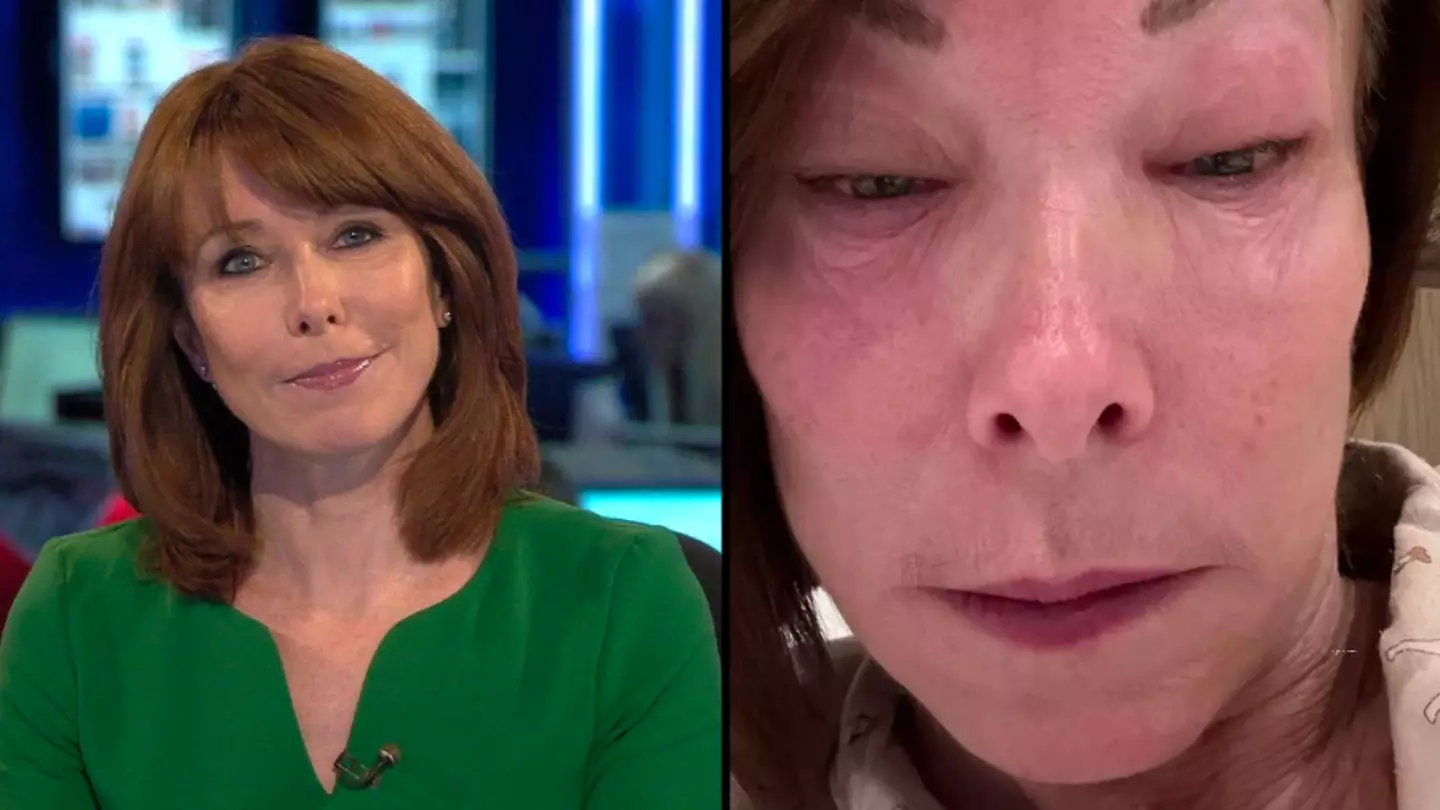 Sky presenter Kay Burley shares shocking picture after being forced off air due to illness