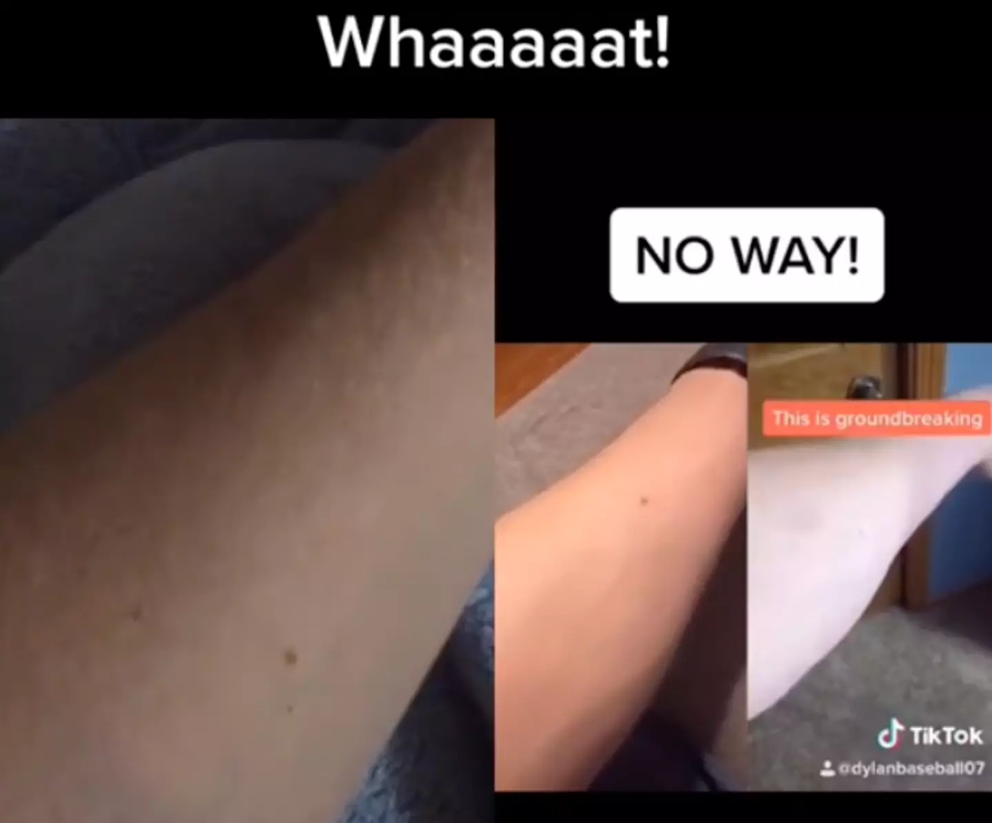 Another TikTok user made a duet to the video and showed his own arm freckle off.