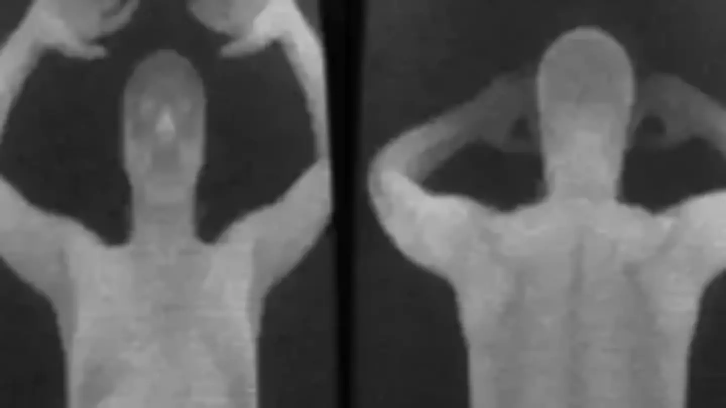 Airports forced to make major changes to X-ray machines after horrifying reality of what security could see revealed