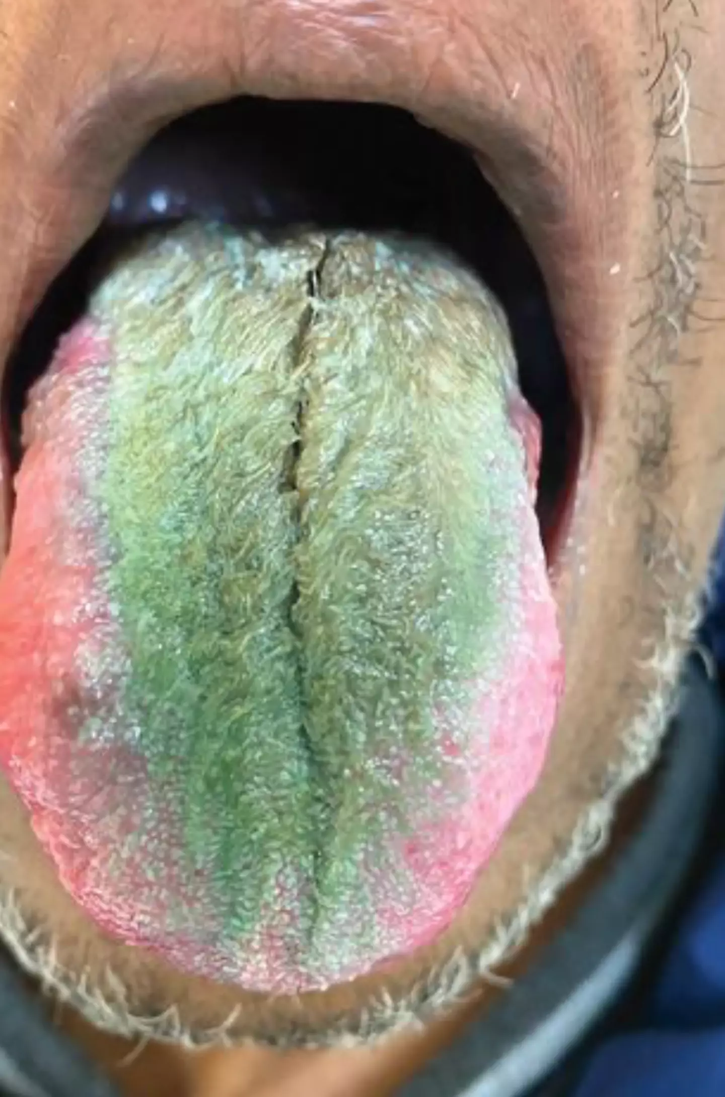 The man's tongue turned green!