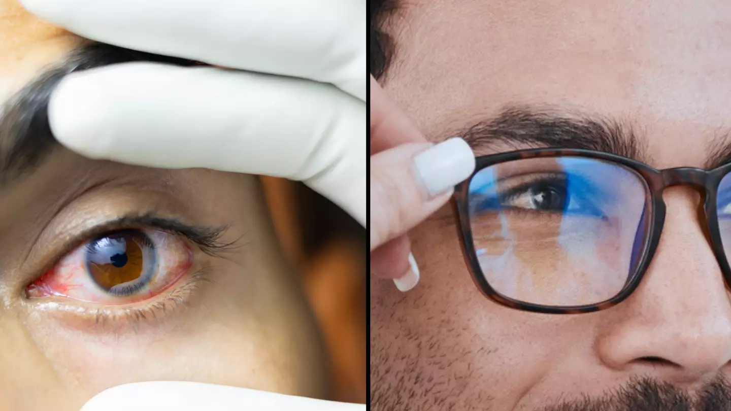 DWP to pay £434 a month to Brits with common eye condition after rule change