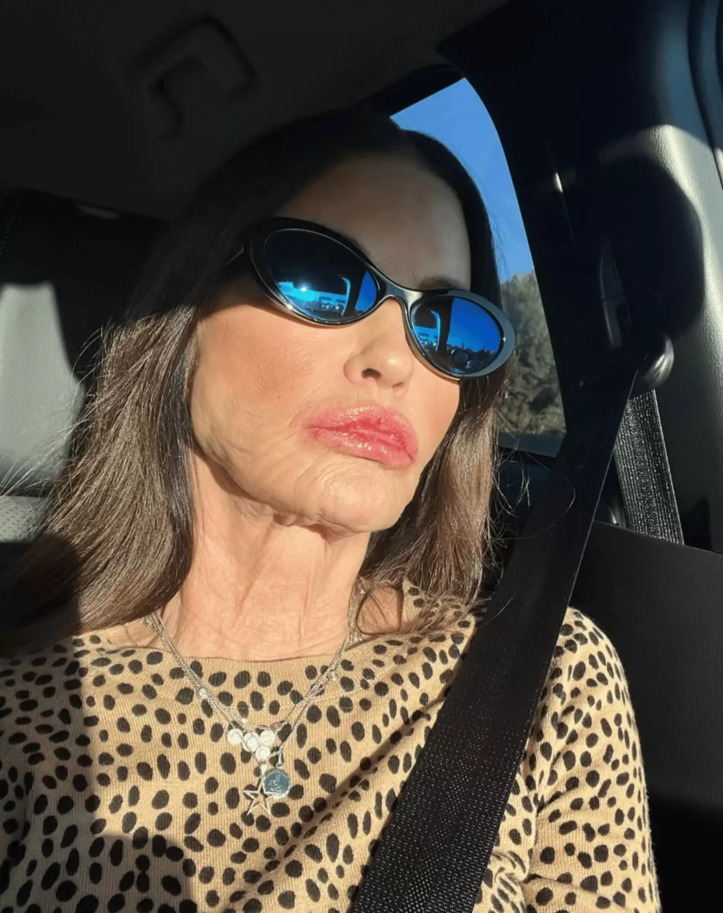 She claims doctors cannot correct her scars (Janicedickinson/Instagram)