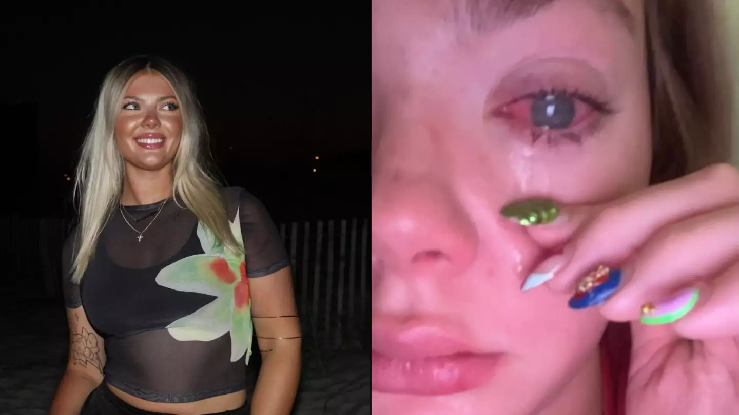 Woman who thought she had sand in her eye loses sight in it after making horrific discovery