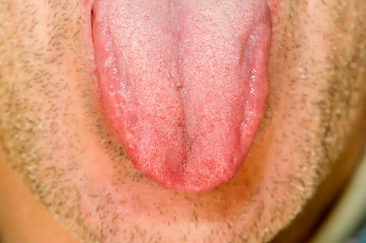 Vaper's tongue is a long-term worry for those with the habit (Getty Stock Photo)
