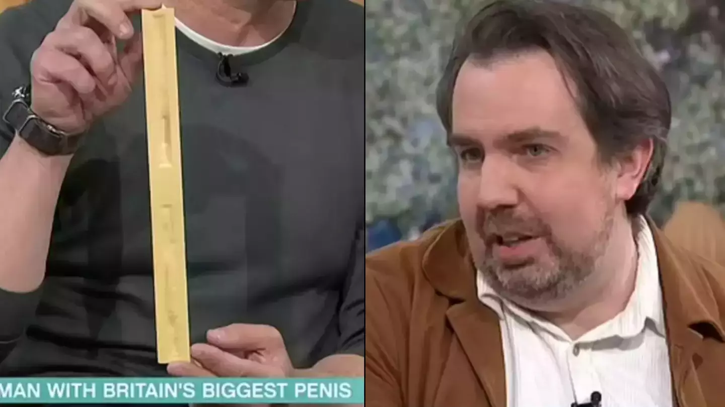 Man with 'world's biggest penis' reveals thing he must do every time he wears shorts