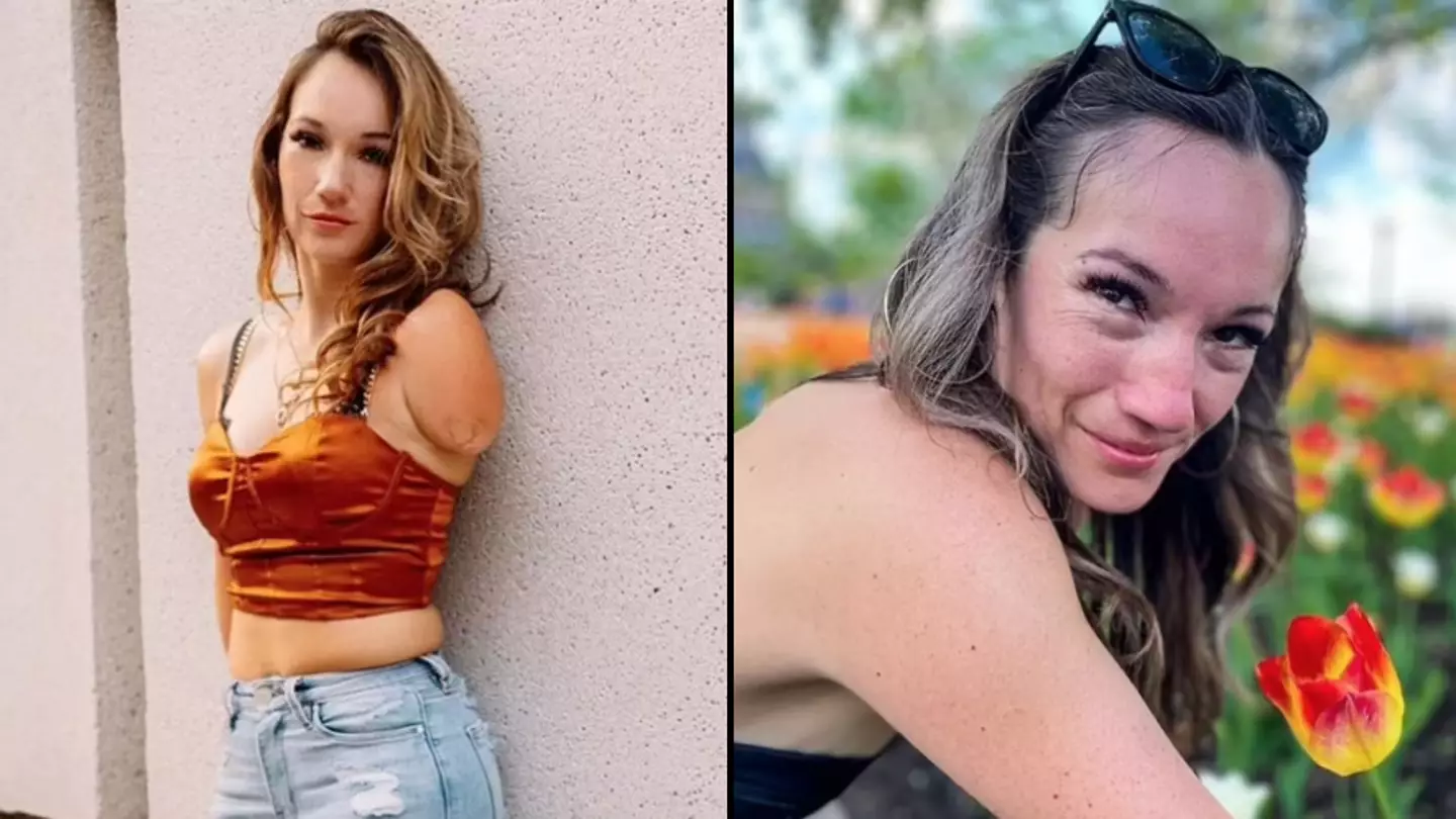 Woman born with one arm and very short legs after mum's failed abortion wants to live life to the fullest