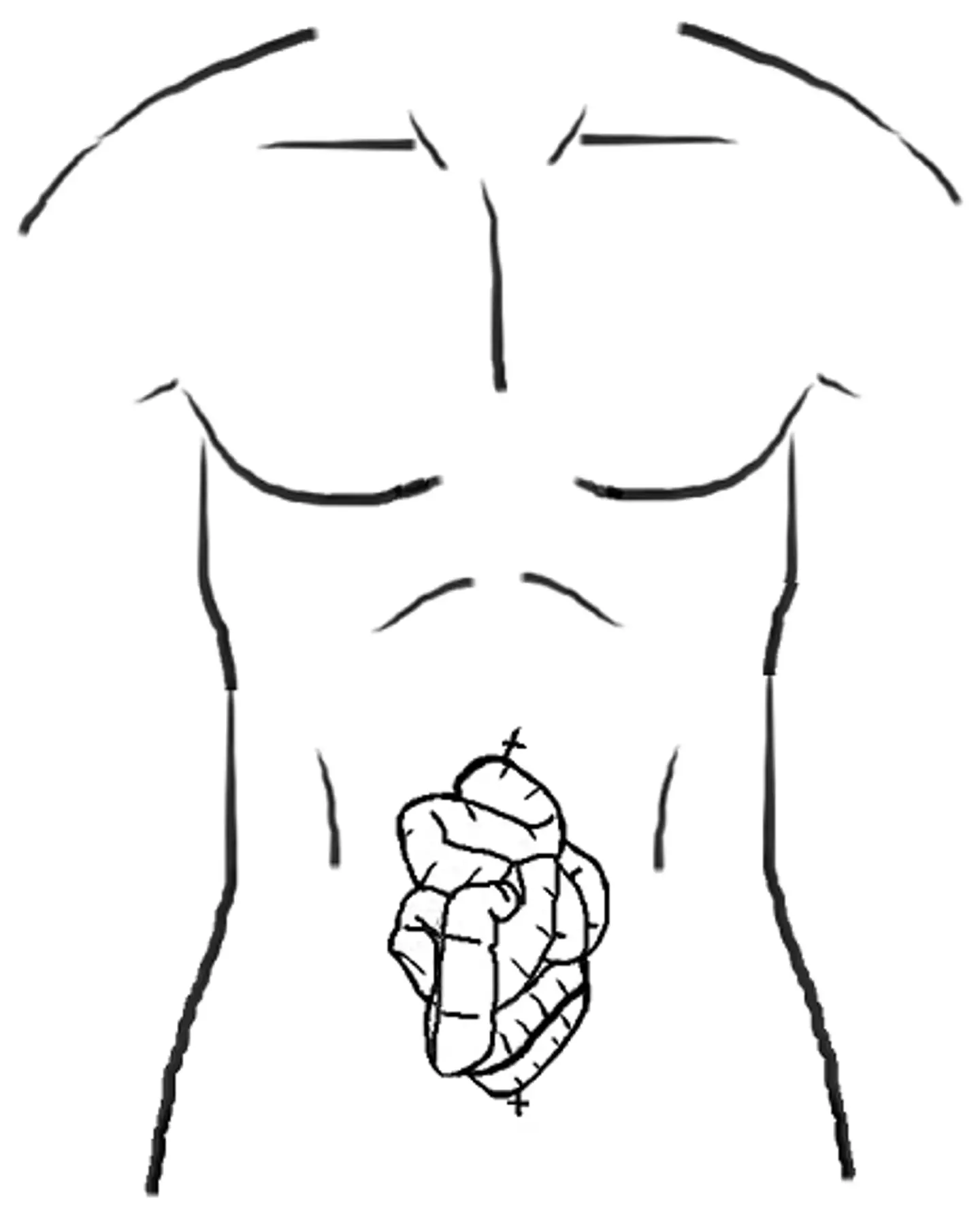 Just to give you an idea of the 63-year-old's condition. (American Journal of Medical Case Reports)