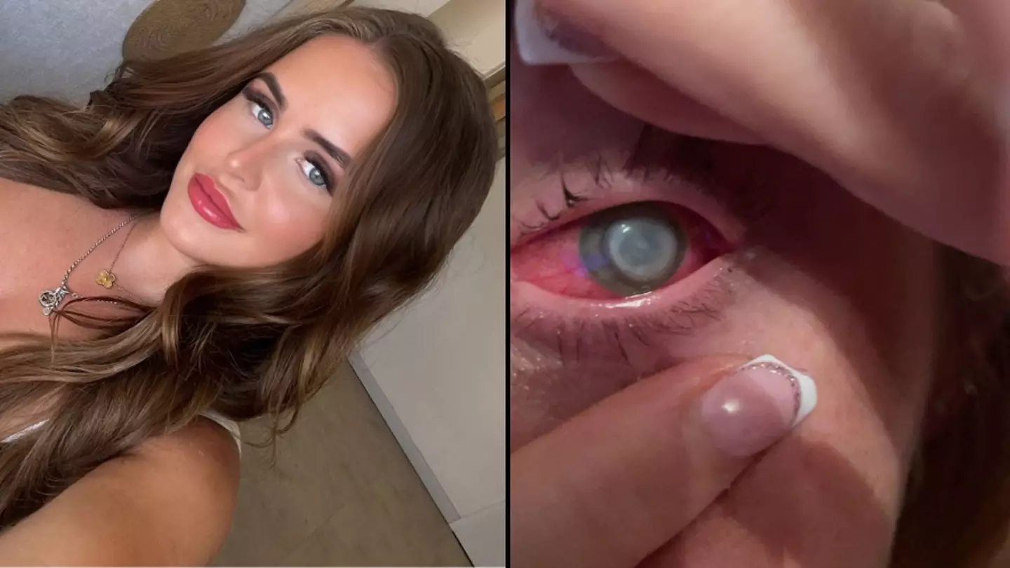 Woman left in tears after going blind for a month when getting eyelash extensions while wearing contact lenses