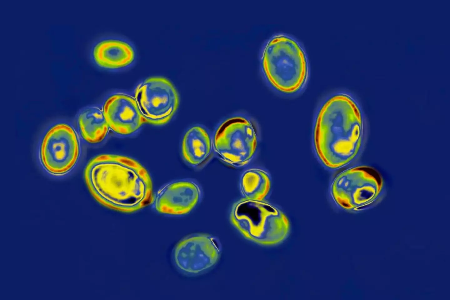 The Candida auris fungus can spread rapidly (BSIP/Education Images/Universal Images Group via Getty Images)