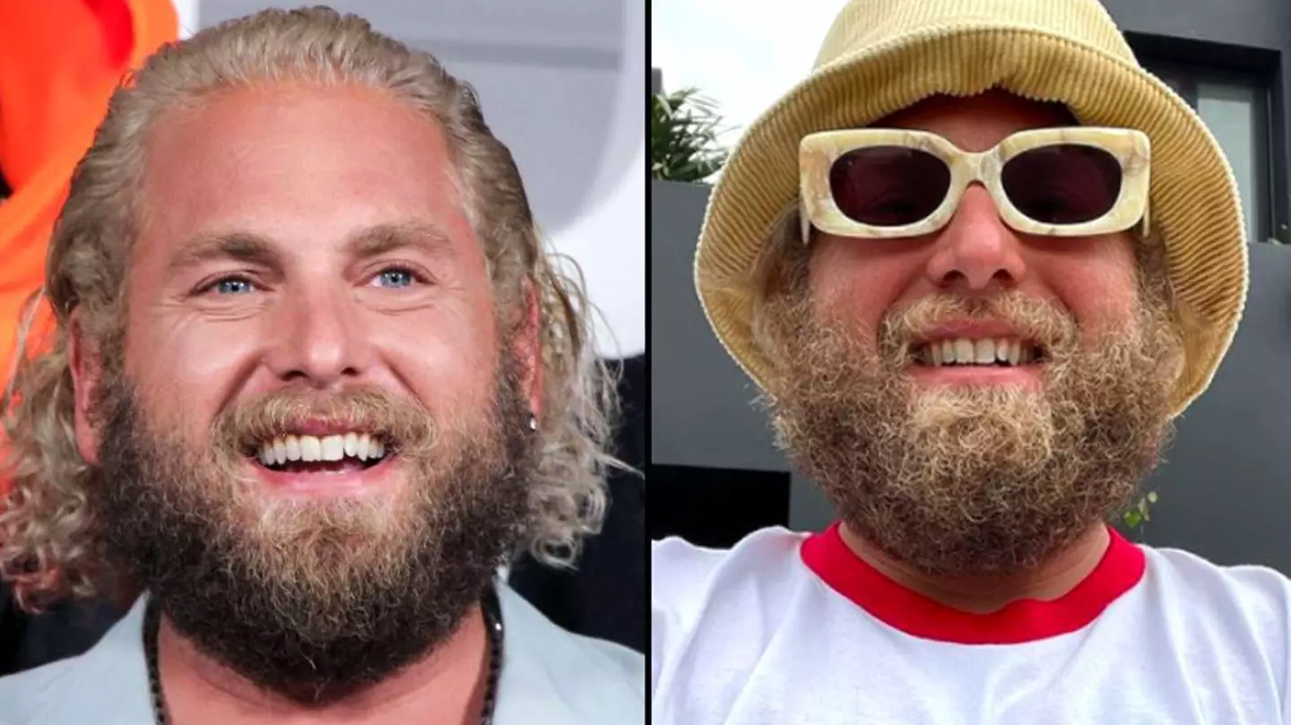 Jonah Hill is taking a break from promoting films after anxiety attacks