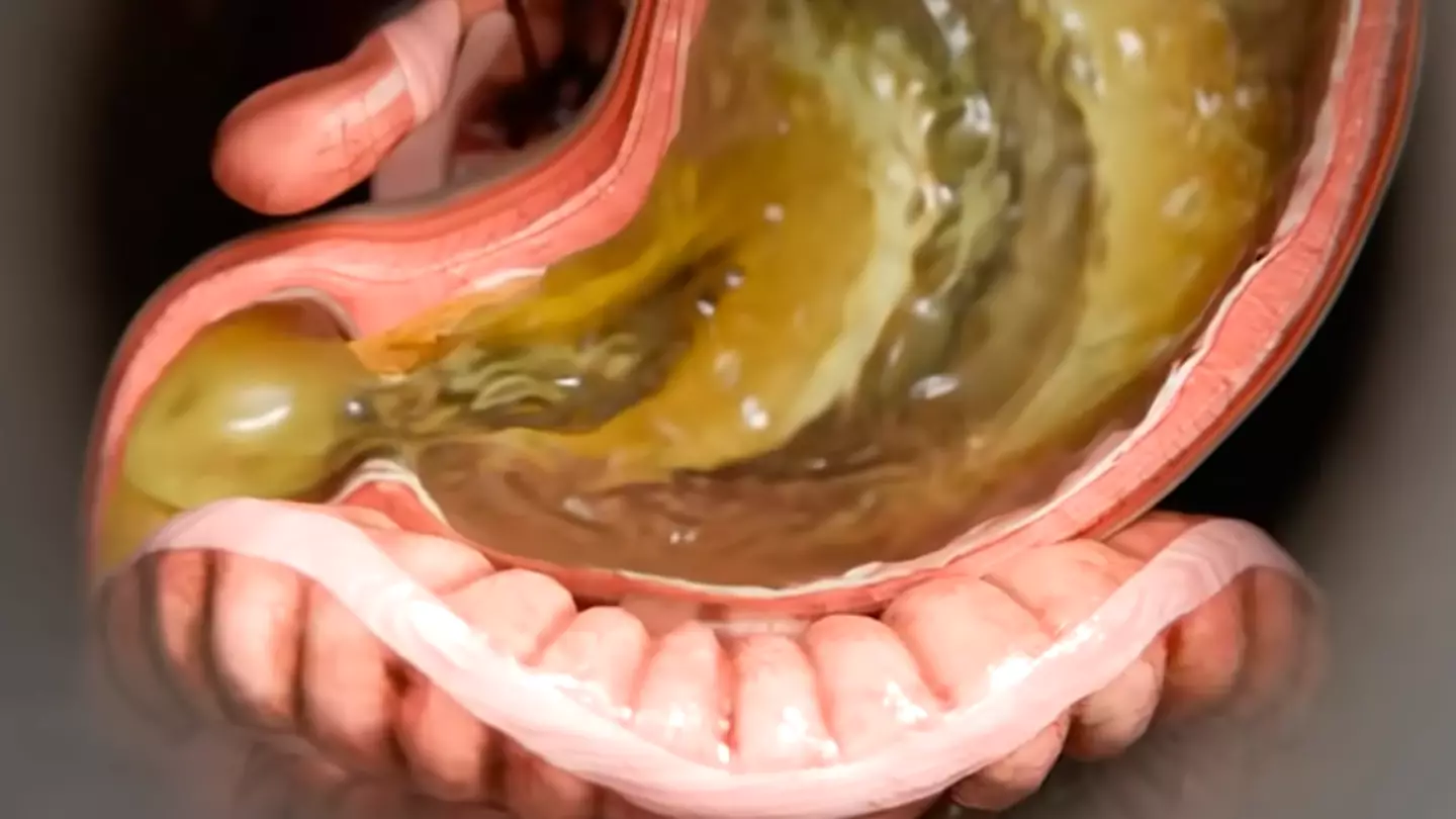 Simulation shows true reality of what Ozempic does to your body as jab is used for weight loss