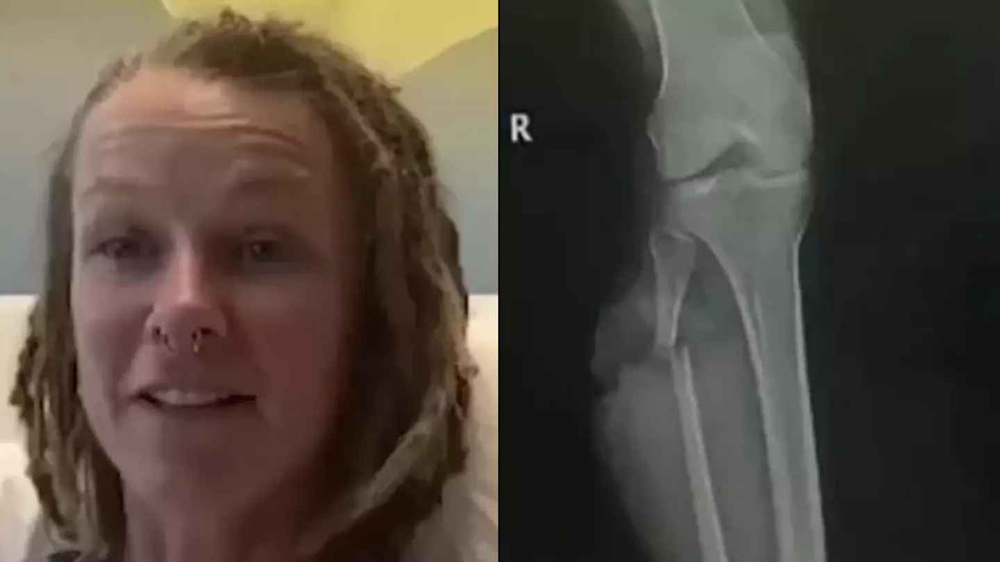 Woman feels lucky to be alive after a dip in her local river ended in brutal alligator attack