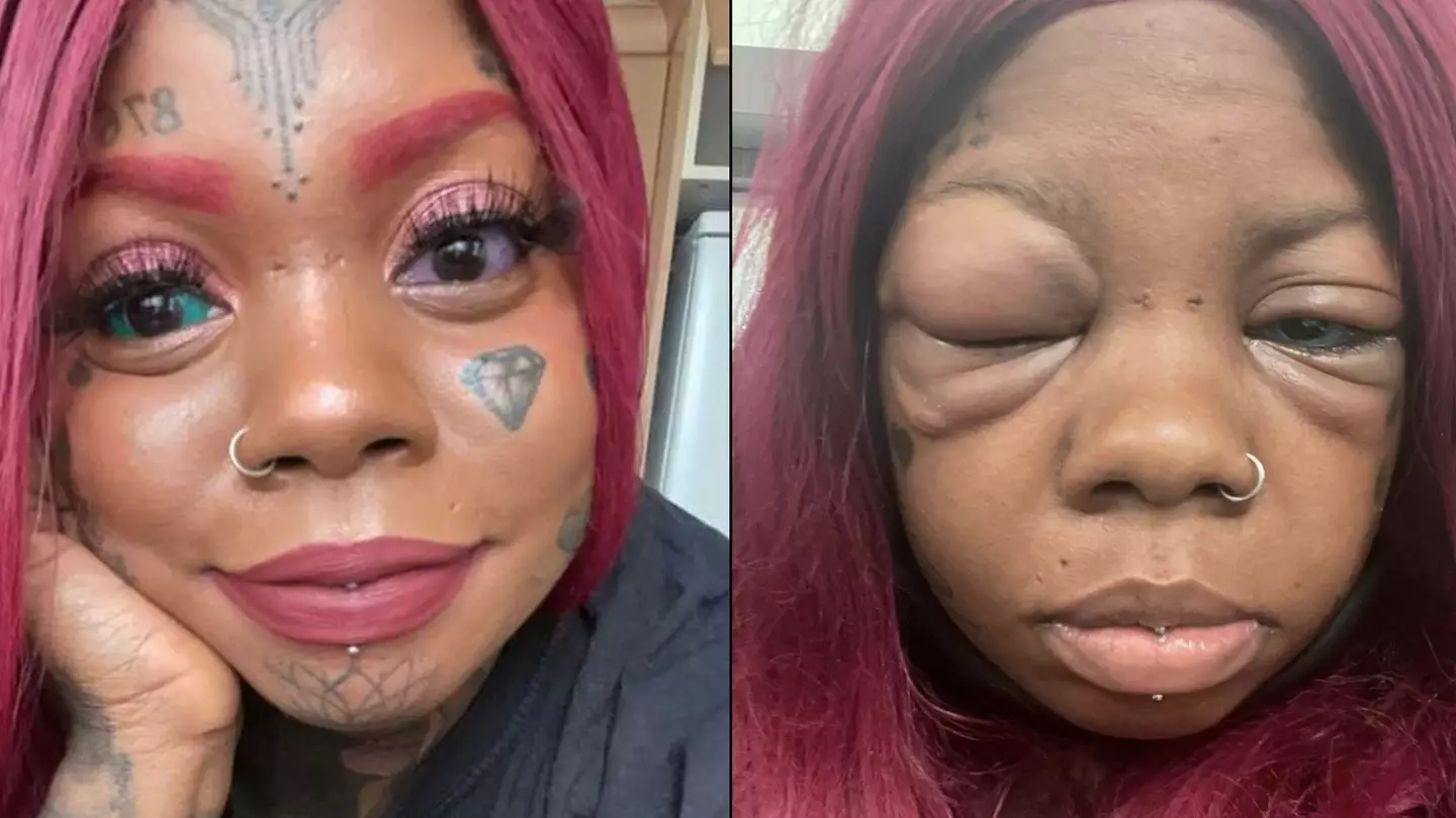 Woman is now going blind after copying 'dragon girl' and getting eyeballs tattooed