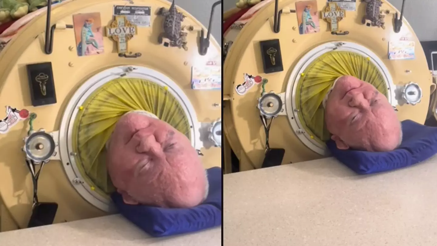Man who has lived inside iron lung for more than 70 years shares what happens when machine loses electricity