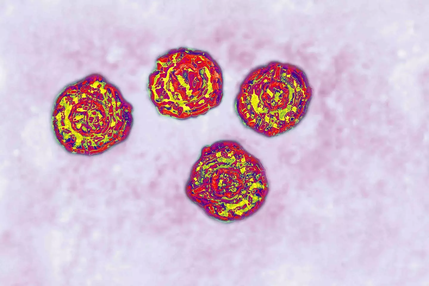 Those who inject steroids could be at risk of having Hepatitis C (CAVALLINI JAMES/BSIP/Universal Images Group via Getty Images)
