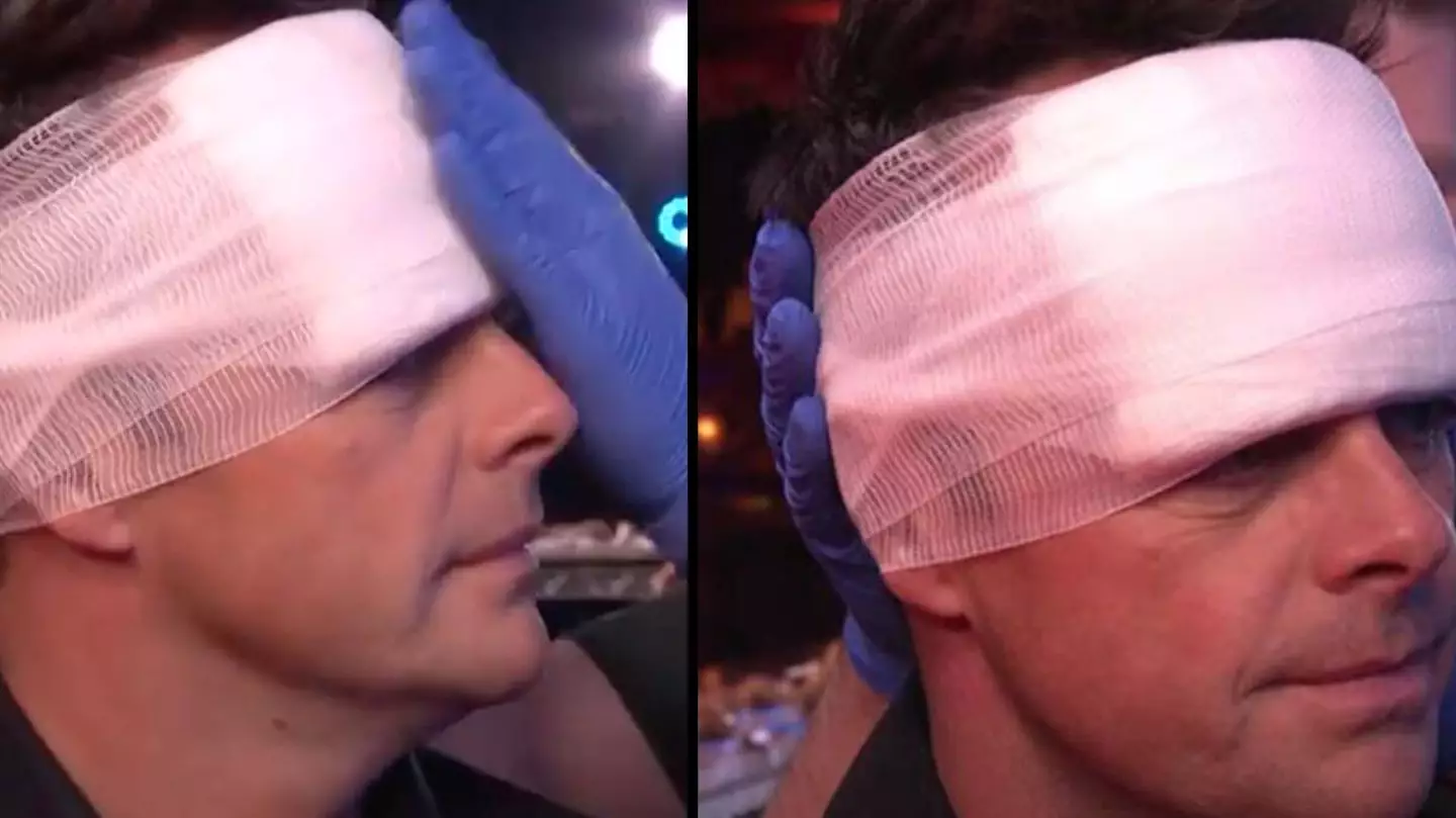 Ant McPartlin Splits Open Forehead During Britain’s Got Talent Filming