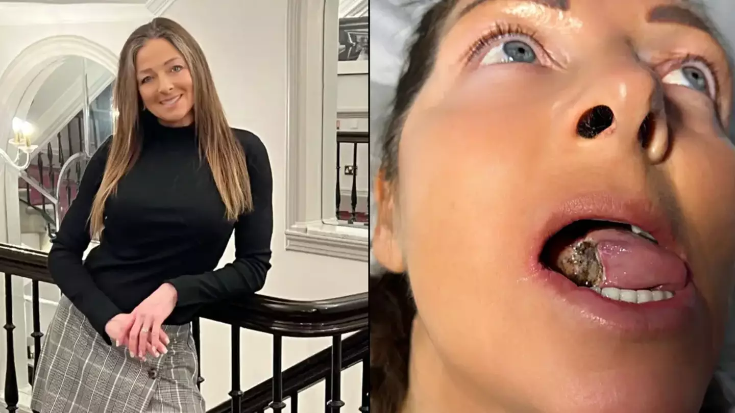 British mum thought she had just bitten her tongue before finding out life-changing diagnosis