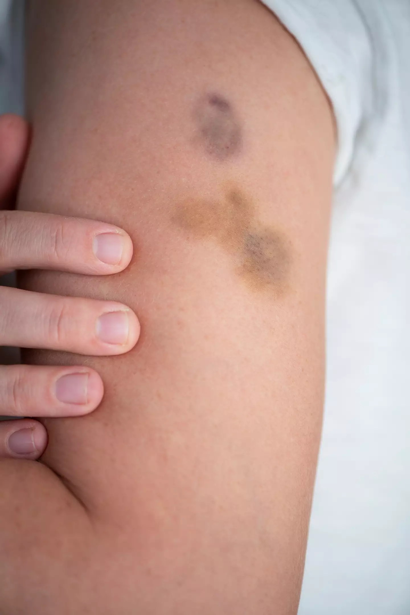 Blood cancer can affect the cells which help your blood to clot, which are called platelets. (Getty Stock Image)